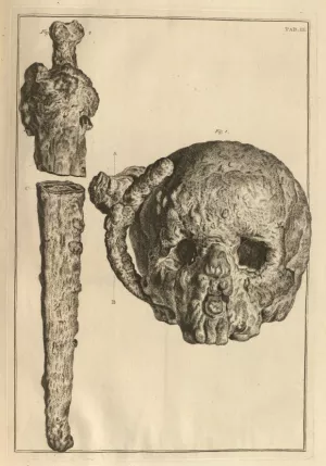 Skull and Bone 